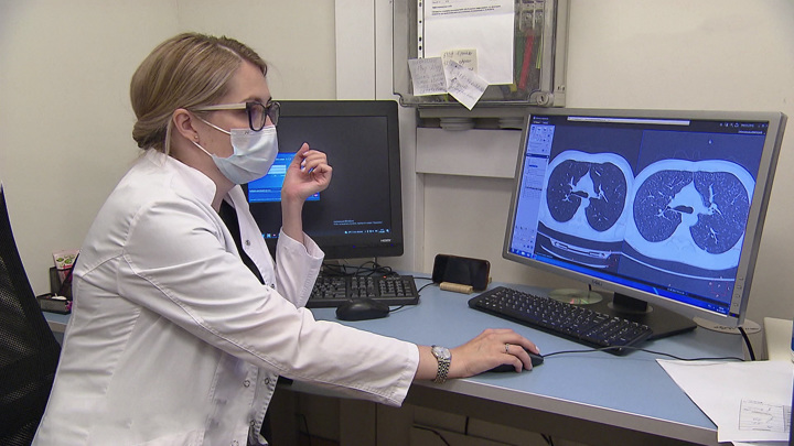 К коронавирусу добавилась еще одна болезнь легких